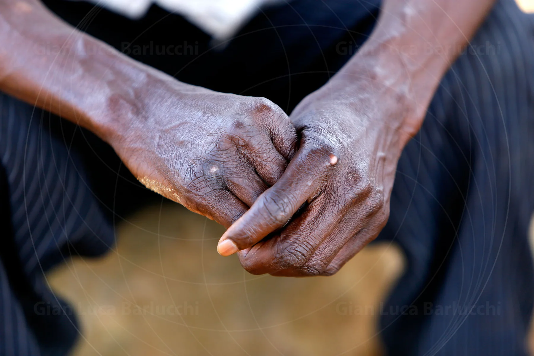 Close-up of weathered hands resting together on a person’s lap